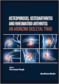 Osteoporosis, Osteoarthritis and Rheumatoid Arthritis: An Agonizing Skeletal Triad (EPUB) Osteoporosis, Osteoarthritis and Rheumatoid Arthritis: An Agonizing Skeletal Triad (EPUB)