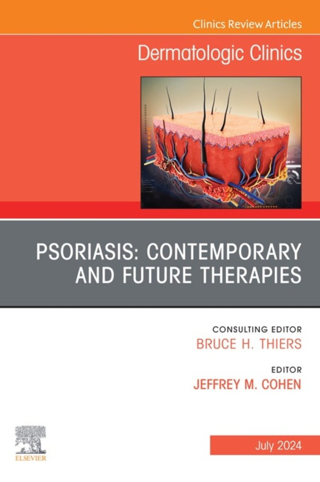 Psoriasis: Contemporary and Future Therapies, An Issue of Dermatologic Clinics (True PDF ) Psoriasis: Contemporary and Future Therapies, An Issue of Dermatologic Clinics (True PDF )