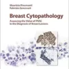 Breast Cytopathology: Assessing the Value of Fnac in the Diagnosis of Breast Lesions (Monographs in Clinical Cytology) (EPUB)