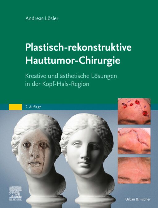 Plastisch-rekonstruktive Hauttumor-Chirurgie: Kreative und ästhetische Lösungen in der Kopf-Hals-Region, 2nd Edition (True PDF )