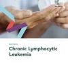 Fast Facts: Chronic Lymphocytic Leukemia (EPUB)