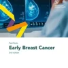 Fast Facts: Early Breast Cancer, 2nd Edition(EPUB)