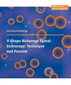 V-shape Bichannel Spinal Endoscopy: Technique and Practice (PDF)