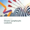 Fast Facts for Patients: Chronic Lymphocytic Leukemia (EPUB)