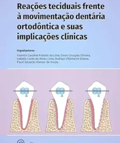 Reações teciduais frente à movimentação dentária ortodóntica e suas implicações clínicas (Portuguese Edition) (EPUB)