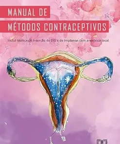Manual de métodos contraceptivos: inclui técnica de inserção do DIU e do Implanon com anestesia local (Portuguese Edition) (EPUB)