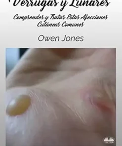 Verrugas Y Lunares: Comprender Y Tratar Estas Afecciones Cutáneas Comunes (Spanish Edition) (EPUB)
