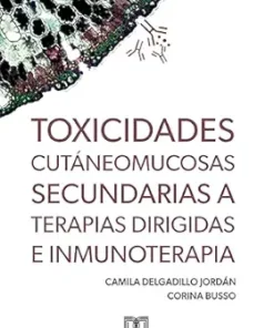 Toxicidades cutáneomucosas secundarias a terapias dirigidas e inmunoterapia (Spanish Edition) (EPUB)
