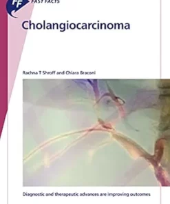 Fast Facts: Cholangiocarcinoma: Diagnostic and Therapeutic Advances Are Improving Outcomes (EPUB)