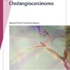 Fast Facts: Cholangiocarcinoma: Diagnostic and Therapeutic Advances Are Improving Outcomes (PDF )