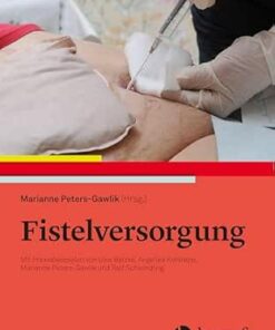 Fistelversorgung: Mit Praxisbeispielen, 2nd Edition (PDF)