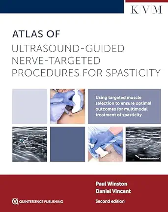 Atlas of Ultrasound-Guided Nerve-Targeted Procedures for Spasticity, 2nd edition (EPUB) Atlas of Ultrasound-Guided Nerve-Targeted Procedures for Spasticity, 2nd edition (EPUB)
