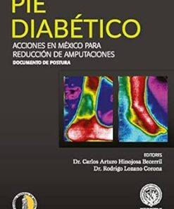 Pie Diabético – Guía Rápida (Spanish Edition) (EPUB)