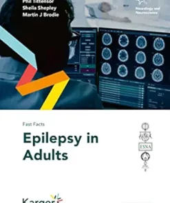 Fast Facts: Epilepsy in Adults (PDF )