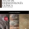 Atlas de dermatología clínica: Pieles oscuras (Salud) (Spanish Edition) (EPUB)