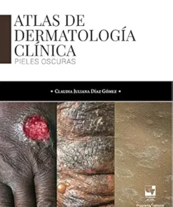 Atlas de dermatología clínica: Pieles oscuras (Salud) (Spanish Edition) (EPUB)