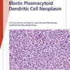 Fast Facts: Blastic Plasmacytoid Dendritic Cell Neoplasm: Shedding Light on a Rare Disease (EPUB)