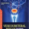 Vesicoureteral Reflux: From Diagnosis to Treatment (PDF)