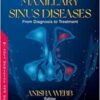 Maxillary Sinus Diseases: From Diagnosis to Treatment (PDF)