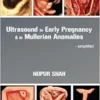 Ultrasound in Early Pregnancy & in Mullerian Anomalies – Simplified (EPUB)