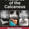 Fractures of the Calcaneus, 2nd Edition (PDF)