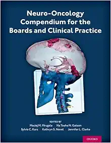 Neuro-Oncology Compendium for the Boards and Clinical Practice (EPUB) Neuro-Oncology Compendium for the Boards and Clinical Practice (EPUB)