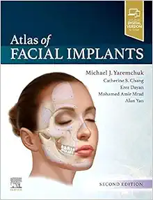 Atlas of Facial Implants, 2nd Edition (PDF)
