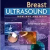 Breast Ultrasound: How, Why and When (EPUB)