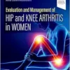 Evaluation and Management of Hip and Knee Arthritis in Women (EPUB)