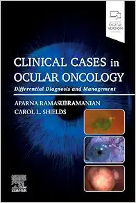Clinical Cases in Ocular Oncology: Differential Diagnosis and Management (EPUB) Clinical Cases in Ocular Oncology: Differential Diagnosis and Management (EPUB)