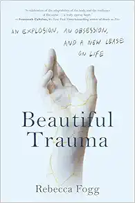 Beautiful Trauma: An Explosion, an Obsession, and a New Lease on Life (EPUB)