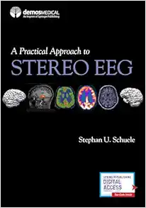 A Practical Approach to Stereo EEG (EPUB) A Practical Approach to Stereo EEG (EPUB)