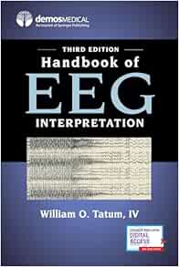 Handbook of EEG Interpretation, 3rd Edition (EPUB) Handbook of EEG Interpretation, 3rd Edition (EPUB)