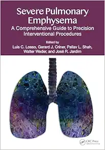 Severe Pulmonary Emphysema:: A Comprehensive Guide to Precision Interventional Procedures (EPUB)