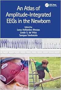 An Atlas of Amplitude-Integrated EEGs in the Newborn, 3rd Edition (EPUB)