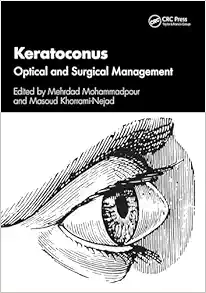 Keratoconus (EPUB)