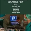 Practical Atlas of Ultrasound for Anesthesia in Chronic Pain (PDF)