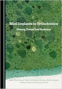 Mini Implants in Orthodontics: History, Design, and Evolution (PDF)