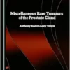Miscellaneous Rare Tumours of the Prostate Gland (PDF)
