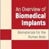 An Overview of Biomedical Implants: Biomaterials for the Human Body (PDF)