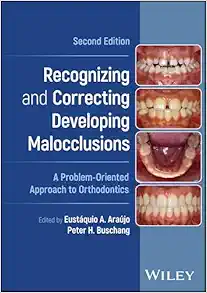 Recognizing and Correcting Developing Malocclusions: A Problem-Oriented Approach to Orthodontics, 2nd Edition (EPUB) Recognizing and Correcting Developing Malocclusions: A Problem-Oriented Approach to Orthodontics, 2nd Edition (EPUB)