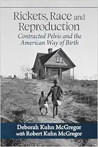 Rickets, Race and Reproduction: Contracted Pelvis and the American Way of Birth (EPUB) Rickets, Race and Reproduction: Contracted Pelvis and the American Way of Birth (EPUB)