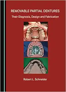 Removable Partial Dentures: Their Diagnosis, Design and Fabrication (PDF)