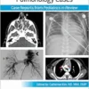 Pediatric Collections: Pulmonology Cases: Case Reports from Pediatrics in Review (PDF )