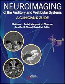Neuroimaging of the Auditory and Vestibular Systems: A Clinician’s Guide (EPUB) Neuroimaging of the Auditory and Vestibular Systems: A Clinician’s Guide (EPUB)