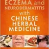 Treating Eczema and Neurodermatitis with Chinese Herbal Medicine (EPUB) Treating Eczema and Neurodermatitis with Chinese Herbal Medicine (EPUB)