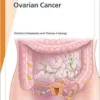 Fast Facts: Ovarian Cancer (PDF)