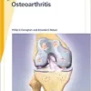 Fast Facts: Osteoarthritis, 3rd Edition (PDF)