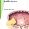Fast Facts: Bladder Cancer, 3rd edition (PDF)