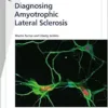 Diagnosing Amyotrophic Lateral Sclerosis (Fast Facts) (EPUB)
